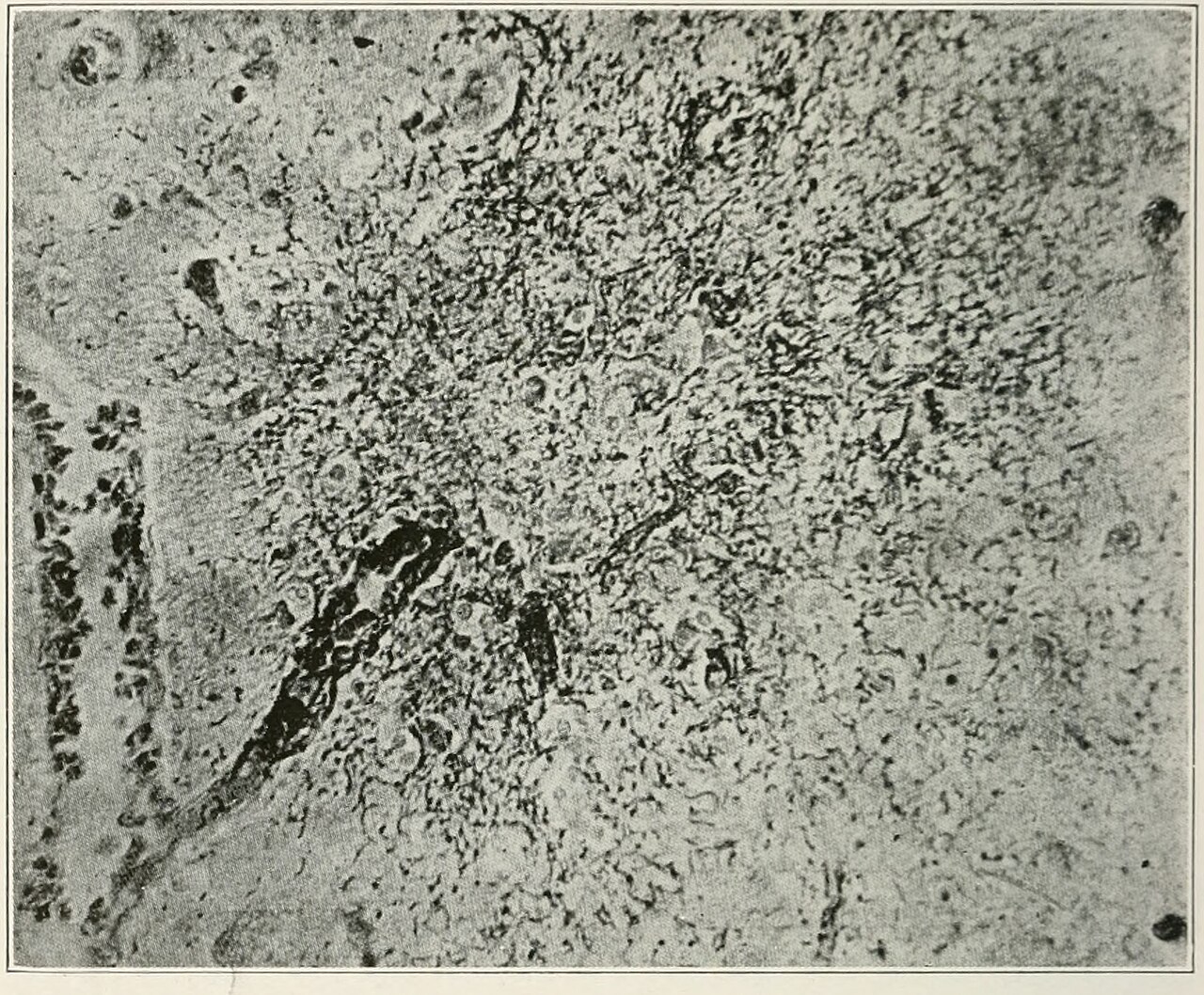 Neurology